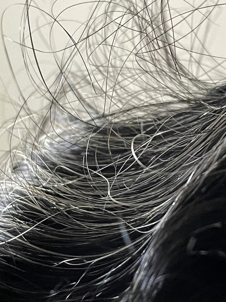 Hair Follicle Miniaturization