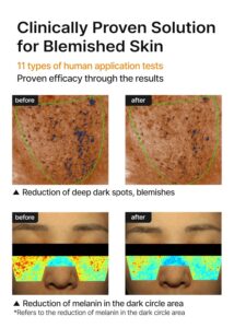 celimax Dark Spot Cream