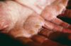 Best Hand Creams for Dry Skin