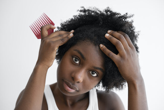 How to Stop Hair Loss